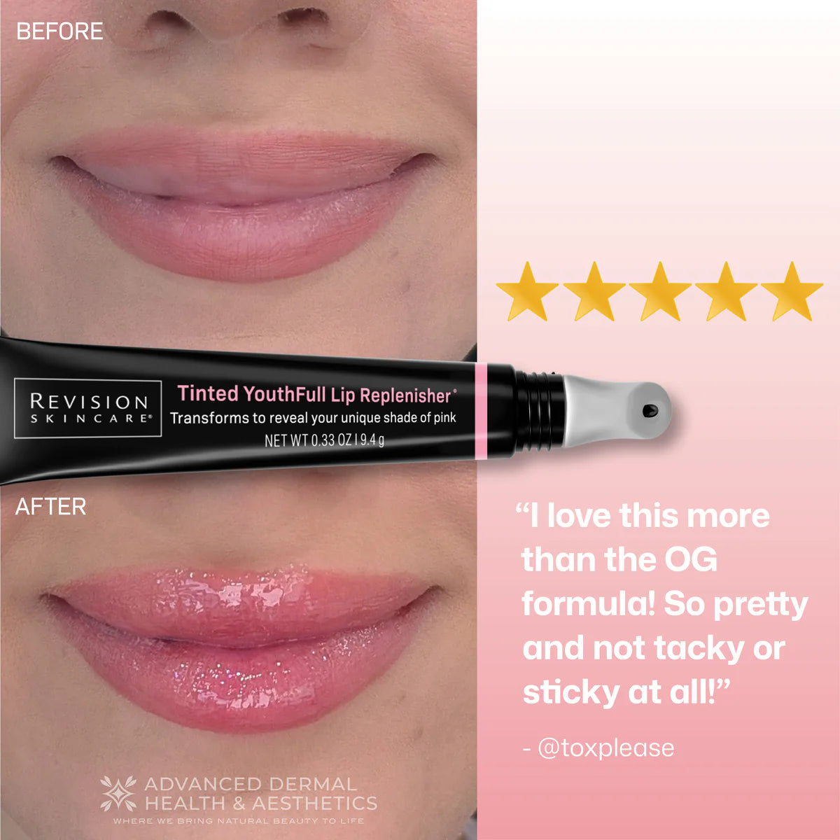 Revision Youthful Lip Replenisher - Tinted