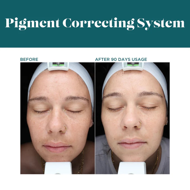 VI DERM PIGMENT CORRECTING SYSTEM